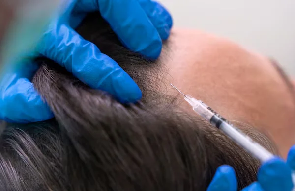 Hair Loss and Trichology Care